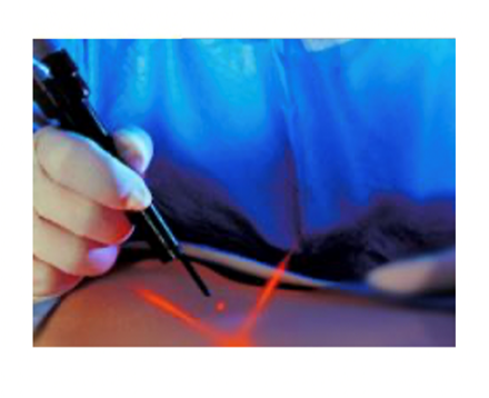 医療用光ファイバ・端末加工